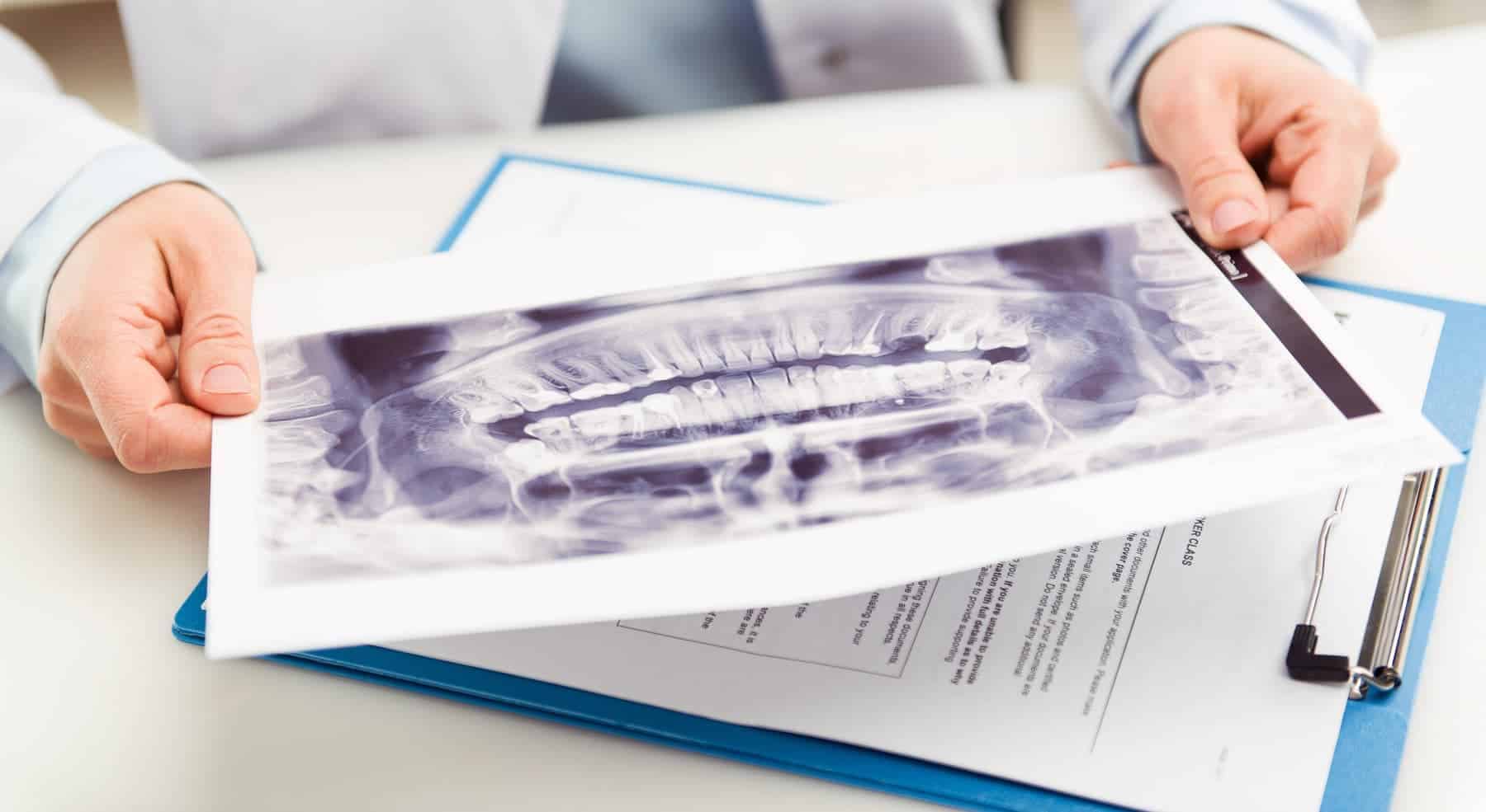 Woman dentist looking at teeth x-ray in dental clinic office